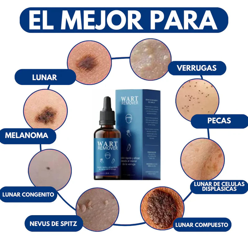 WART REMOVER™ - REMOVEDOR DE IMPERFECCIONES 8 EN 1